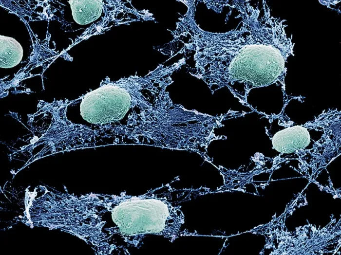 Impression encadrée : Cellules, SEM Impression encadrée : Cellules, SEM