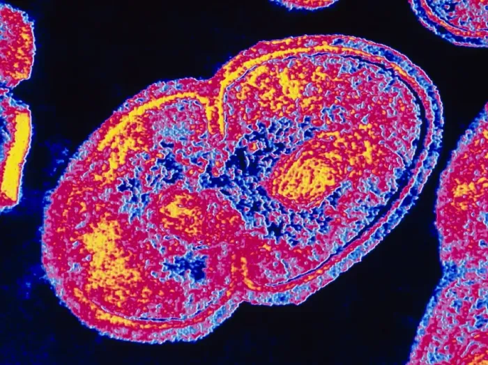 Impression encadrée : L'IRM de couleur d'Enterococcus faecalis