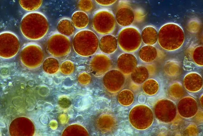 Impression encadrée : Hématococcus algues, microscope à lumière Impression encadrée : Hématococcus algues, microscope à lumière