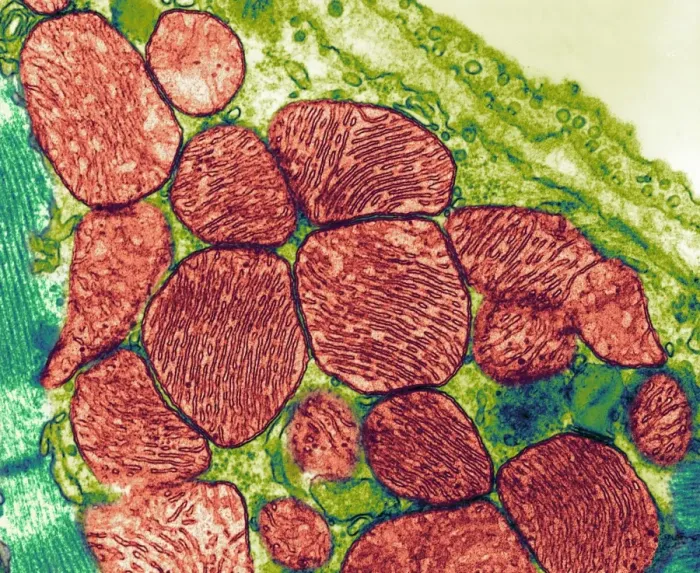 Impression encadrée : Les mitochondries, TEM Impression encadrée : Les mitochondries, TEM
