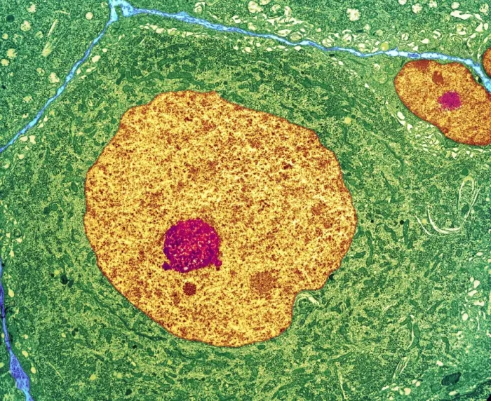 Impression encadrée : Cellule nerveuse, TEM Impression encadrée : Cellule nerveuse, TEM