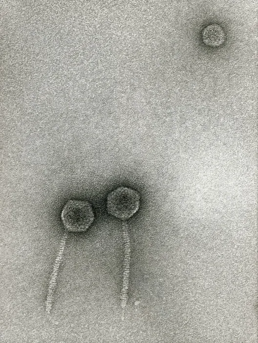 Impression encadrée : Bactéries de phages lambda TEM