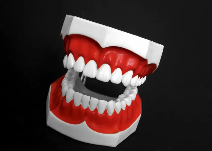 Impression encadrée : Modèle de denture. Impression encadrée : Modèle de denture.