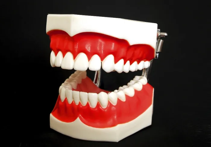Impression encadrée : Modèle de denture Impression encadrée : Modèle de denture