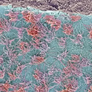 Brain Surface Print, SEM Image