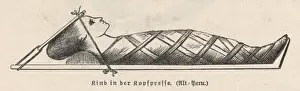 Historical Medical Equipment Impressions: Compression of Head