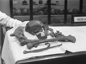 Medical Anatomy Impressions: Human Bones