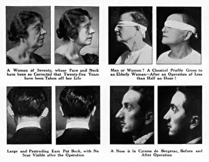 Plastic Surgery Before And After Impressions: Plastic Surgery - Before and After