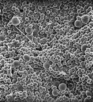 Bee Pollination Process Impressions: Pollen on bee