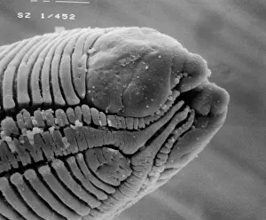 Scanning Electron Microscope Photos Impressions: Roundworm