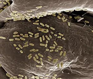 Scanning Electron Micrograph Impressions: Scanning Electron Micrograph (SEM): E