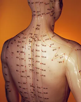 Modèle dacupuncture