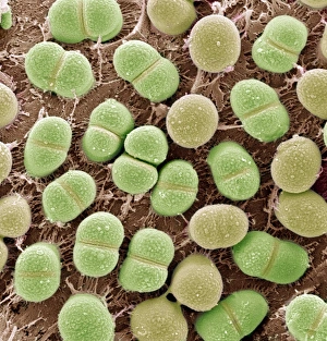 Coloured Scanning Electron Micrographs Impressions: Algae, SEM