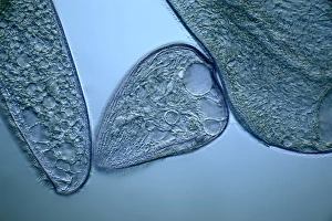 Light Microscopy Images Impressions: Blepharisma protozoa, light micrograph