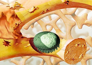 Impressions de La resorption des os. L'artwork informatique d'une ostéoclaste (vert, cellule qui détruit les os) en destruction de morceau d'os Images datées de 2004 septembre: Résorption des osseux