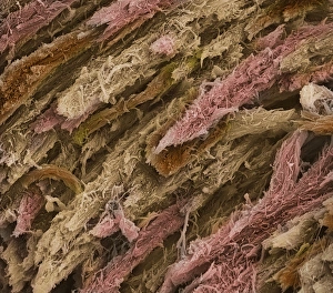 Impressions de Os spongieux. Micrographie électronique à balayage colorée (SEM) de l'os spongieux congelé fracturé Images datées de 2001 octobre: Os, SEM.