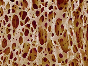 Impressions de Le tissu osseux. Micrographie électronique de scanonnement colorée (SEM) du tissu cancellé (spongy). Le tissu osseux peut être soit cortical (compact), soit cancellé Images datées de 2004 septembre: Tissu osseux
