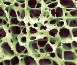 Cancellous Bone Structure Impressions: Bone tissue, SEM