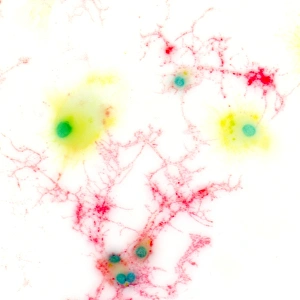 Brain Cell Structure Impressions: Brain cells, light micrograph