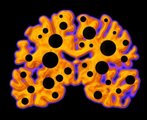Images datant de 2000: Dommages au cerveau
