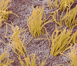 Impressions de La ligne du cerveau. Micrographie électronique de scan (SEM) colorée de la ligne du cerveau, montrant les poils des cellules ependymales (orange) Images datées de 2012 mars: Même de cerveau, SEM