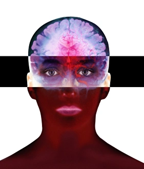 Nervous System Diagrams Impressions: Brain scan