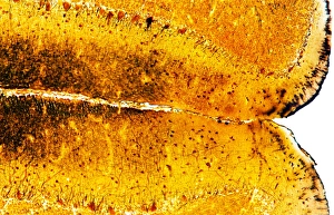 Light Microscopy Images Impressions: Brain tissue, light micrograph