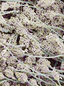 Coloured Scanning Electron Micrographs Impressions: Bread mould