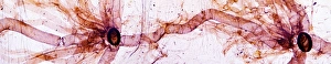 Light Microscopy Images Impressions: Caterpillar spiracles, light micrograph