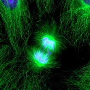 Impressions de La division cellululaire. Photographie à fluorescence immunofluorescente d'une cellule épithéliale humaine au centre pendant la phase anaphase tardive de l'apoptose mitotique Images datées de 2011 août: La division cellulaire, photographie à fluorescence