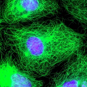 Impressions de La division des cellules. Micrographie à fluorescence immunofluorescente d'une cellule épithéliale humaine (centre) au stade interphasique de la mitose Images datées de 2011 août: La division cellulaire, image à fluorescence microscopique