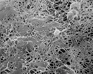 Images datées de 1985: Les microfibrilles de cellulose d'une paroi cellulaire