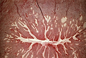 Female Reproductive System Anatomy Impressions: Cervix, light micrograph