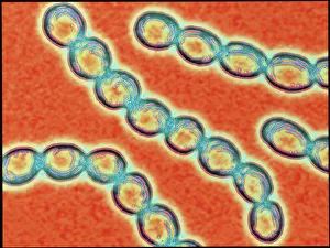 Images datées du 26 mars 2012: Chaines de bactéries Stréptocoques du genre Pyogènes