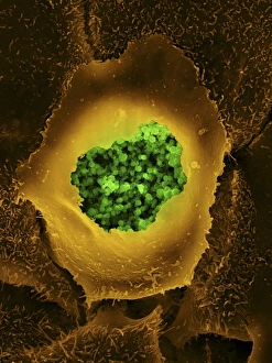 Coloured Scanning Electron Microscopy Impressions: Chlamydia, SEM