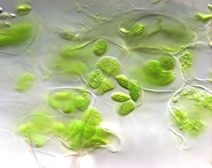 Photosynthesis Process Impressions: Chloroplasts, light micrograph