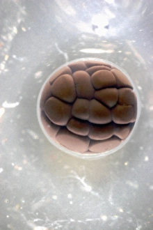 Cell Division Micrograph Impressions: Cleavage in frog egg, light micrograph