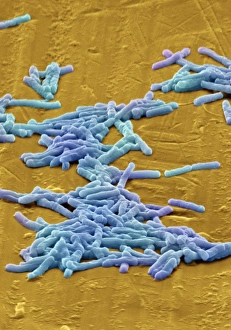 SEM Impressions: Les bactéries Clostridium difficile, microscopie électronique à balayage (SEM)