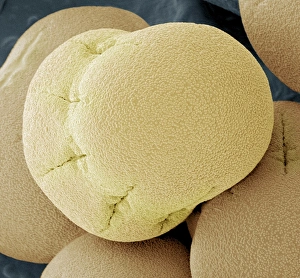 SEM Images Of Pollen Impressions: Comfrey pollen, SEM