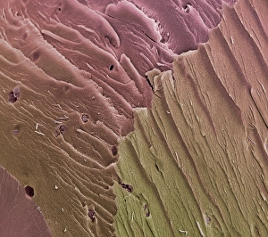 Knee Joint Anatomy Impressions: Compact bone, SEM