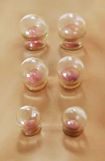 Impressions de Le modèle est autorisé à utiliser le thérapie de la coupe du sang Images datées de 2006 avril: Cupping