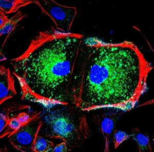 Light Micrograph Images Impressions: Dividing cell, light micrograph
