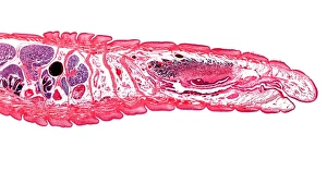 Lumbricus Terrestris Impressions: Earthworm, longitudinal section