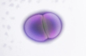 Electron Microscopy Images Impressions: Enterococcus faecalis dividing, TEM