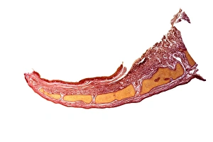 Impressions de L'épiglotte. Micrographie en lumière de section longitudinale de l'épiglotte, la flèche tissulaire située à la partie supérieure du larynx (voix) Images datées de 2012 février: L'épiglotte, micrographe de lumière
