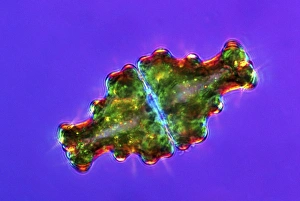 Polarised Light Microscopy Impressions: Euastrum desmids, light micrograph