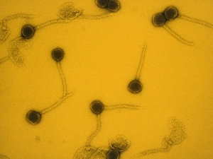 Virology Images Impressions: False-col TEM of Lambda bacteriophages
