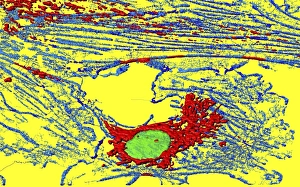 Mitochondria Energy Production Impressions: Fibroblast cell, fluorescent micrograph