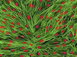 Light Micrograph Images Impressions: Fibroblast cells, light micrograph