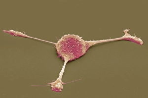 Cell Biology Images Impressions: Fibroblast, SEM